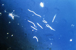  Borrelia burgdorferi  en microscopie à fond noir