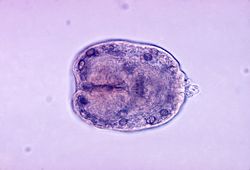  Scolex d'Echinococcus granulosus