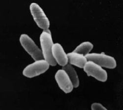  Halobacterium sp. souche NRC-1.Chaque cellule a environ 5 μm de longueur.