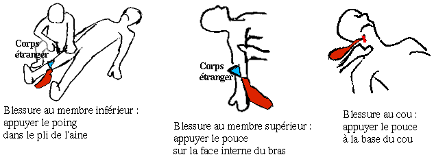 Les études du sport pour ceux-là chez qui la varicosité