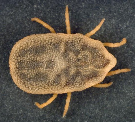 E des parasites de la personne