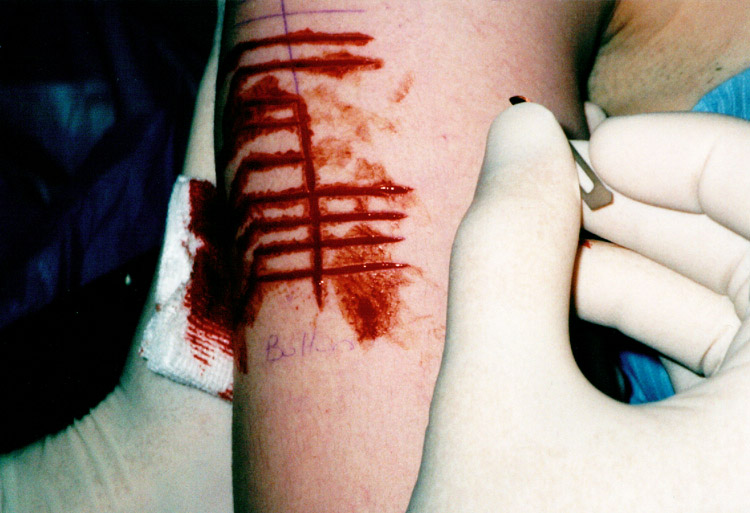 http://fr.academic.ru/pictures/frwiki/83/Scarification.jpg