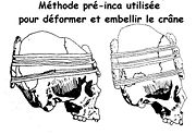 Crânedéforméméthode.jpg