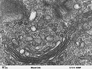 Human leukocyte, showing golgi - TEM.jpg