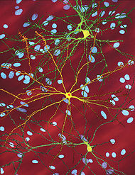 Neuron with mHtt inclusion.jpg