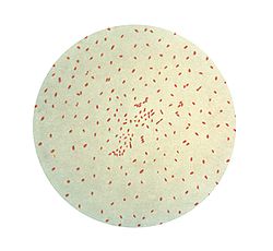  Bordetella pertussis (coloration de Gram)