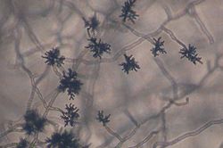  Exemple de Cladosporium, vu au microscope