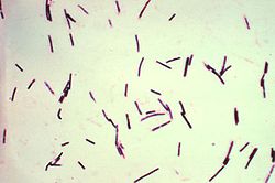  Un groupe de bactéries Clostridium perfringens