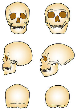  Comparaison des crânes d’Homo sapiens (à gauche) etd’Homo neanderthalensis (à droite)