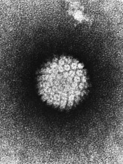  HPV au microscope électronique