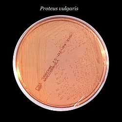  Proteus vulgaris sur gélose Mac Conkey
