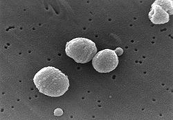  Photographie au microscope de bactéries Streptococcus pneumoniae