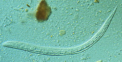  premier stade larvaire de Strongyloides stercoralis