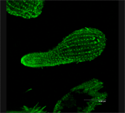  Répartition de la β-tubulinechez Tetrahymena sp. (marquage à la GFP)